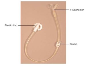 Percutaneous Endoscopic Gastrostomy (PEG) Discharge Advice - North Tees ...