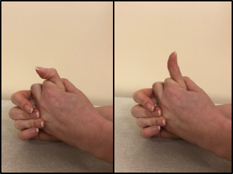 bending thumb exercise